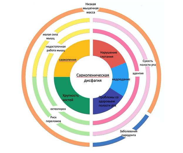 Саркопеническая дисфагия, недоедание и недостаточность функций ротовой полости у пожилых