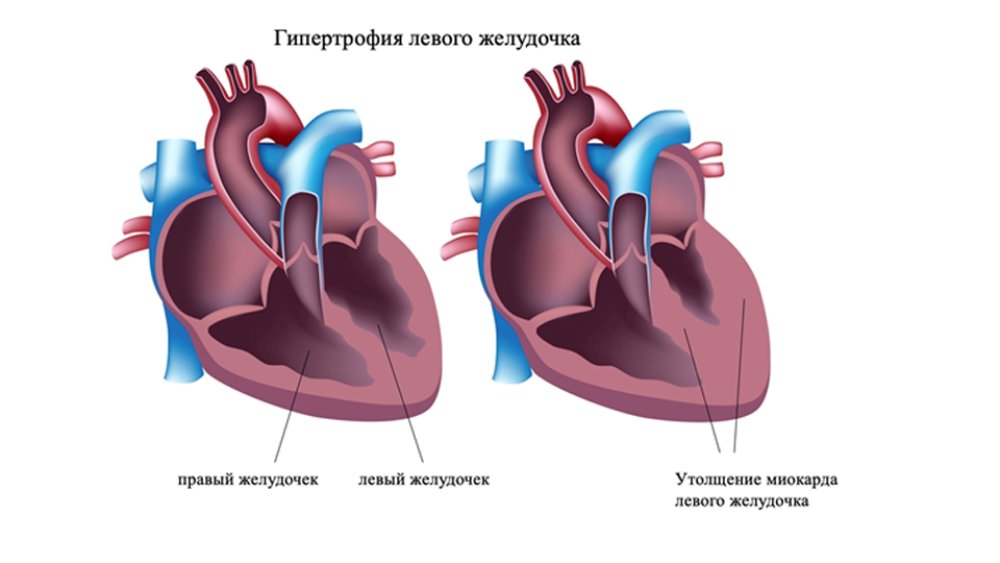 сердце